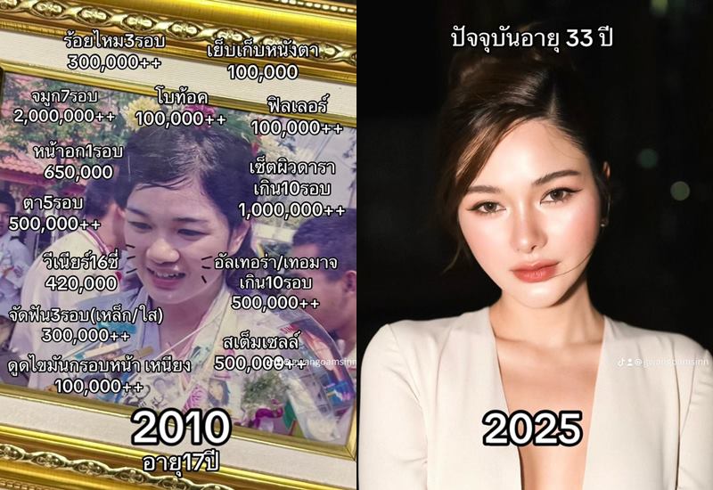 ภาพก่อนศัลยกรรมดาราสาว บอกไม่มีกั๊กทำอะไรบ้าง หมดกว่า 6 ล้าน ตอบชัด ๆ คุ้มไหม ?