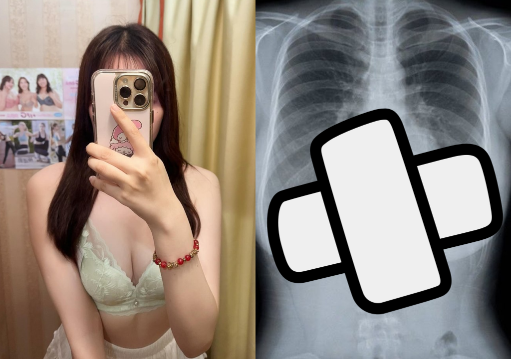 สาวโพสต์ภาพ X-Ray ทำคนหลุดโฟกัส กลายเป็นประเด็นร้อน ชี้มีจุดแปลก ๆ ไหม